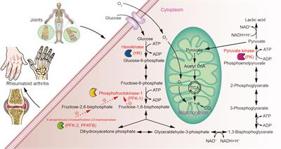 Glycolysis Rate-Limiting Enzymes: Novel Potential Regulators of Rheumatoid Arthritis Pathogenesis